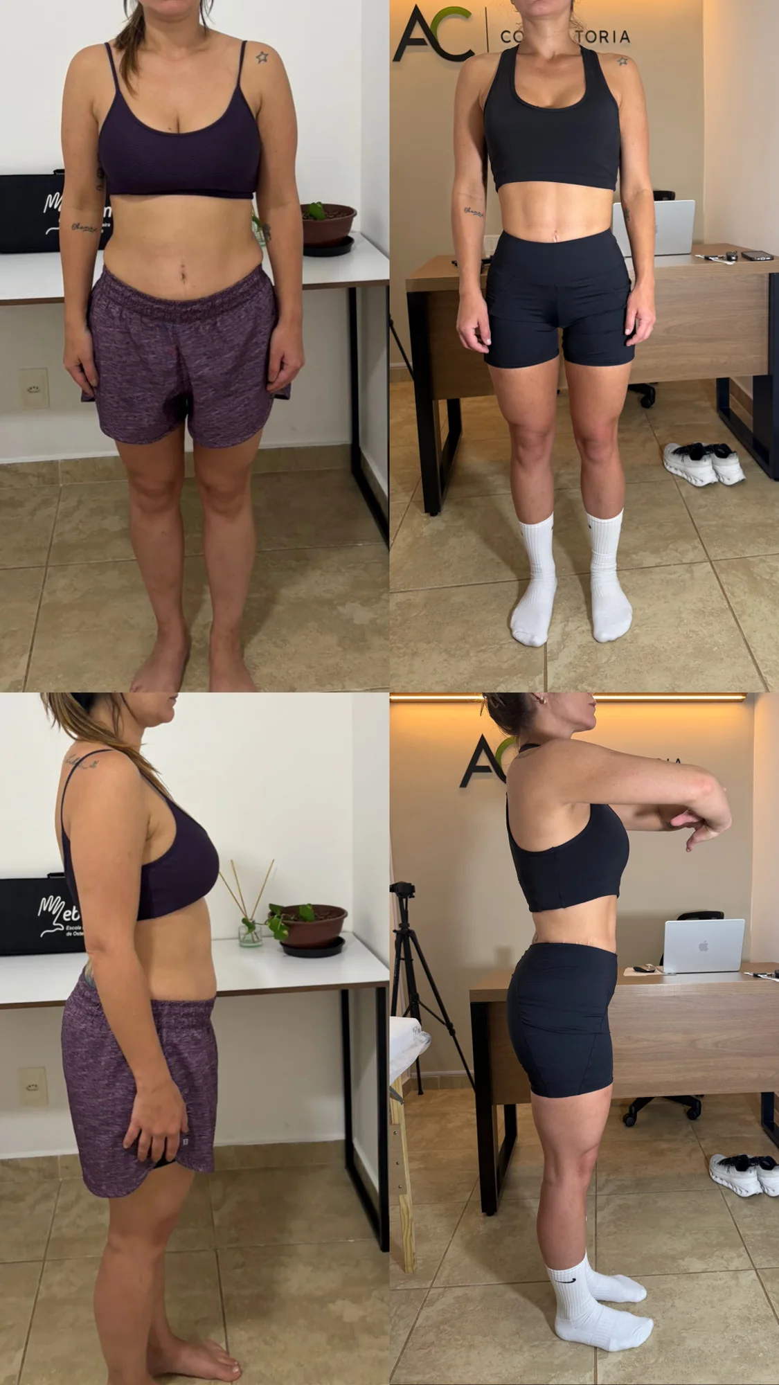 Antes e depois — aluna 02 do Método CTR