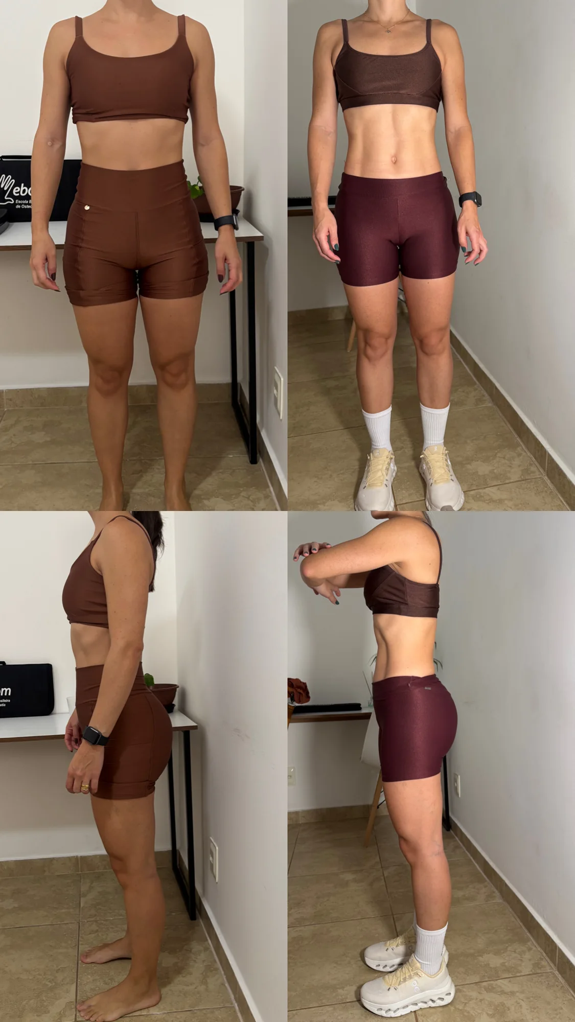Antes e depois — aluna 03 do Método CTR
