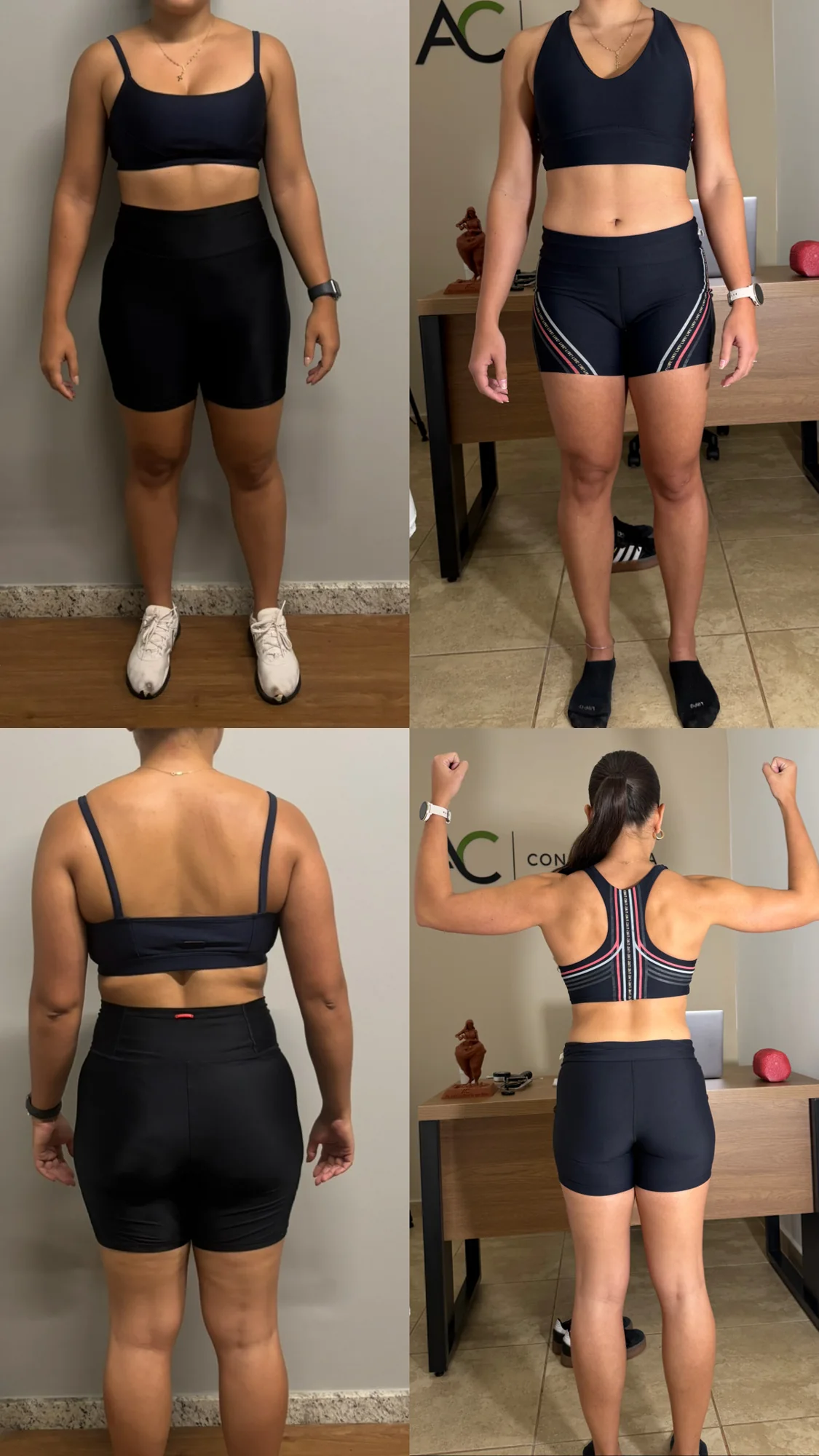 Antes e depois — aluna 04 do Método CTR