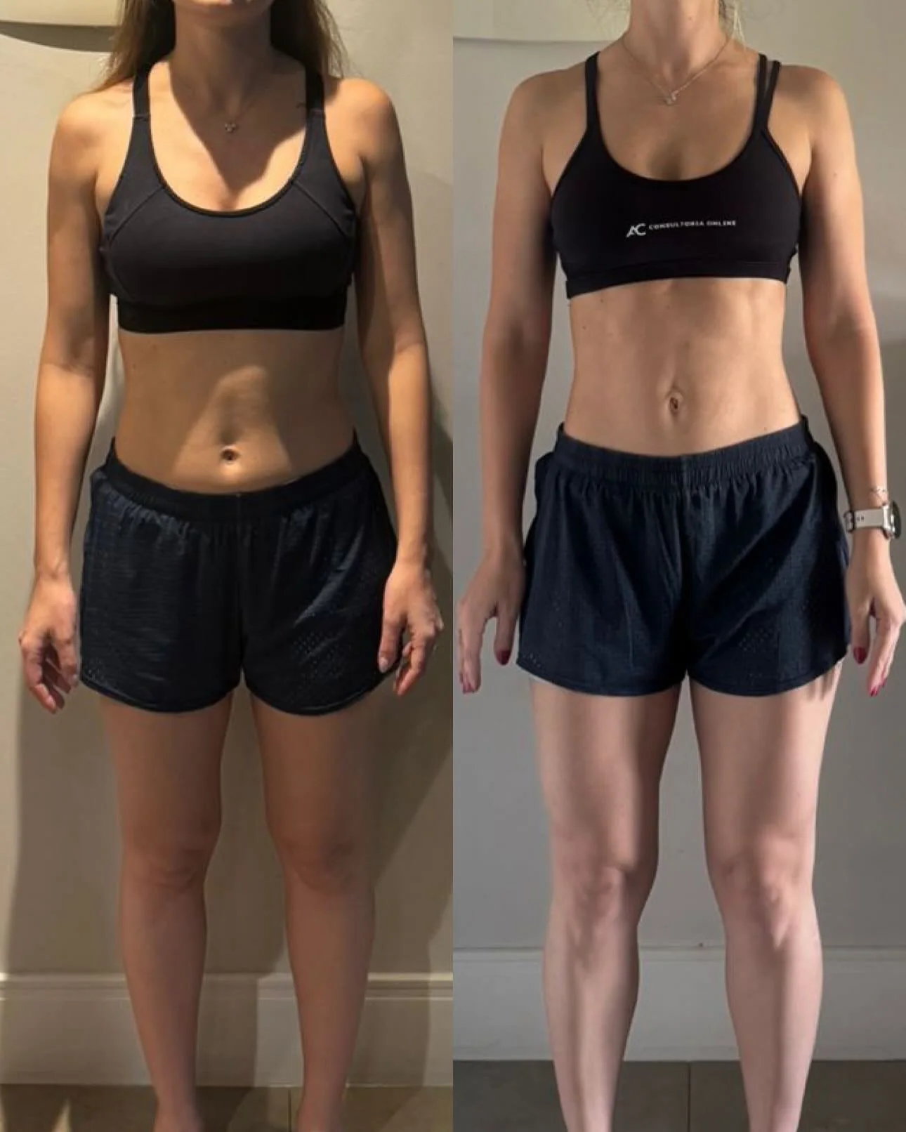 Antes e depois — aluna 05 do Método CTR